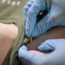 What is Dry Needling?