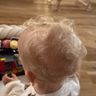 Zahnschmerzen Baby & Kinder